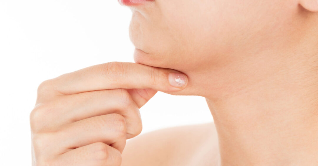 Can I Reduce My Double Chin Without Surgery?
