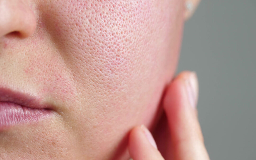 Address Common Skin Concerns in Melbourne