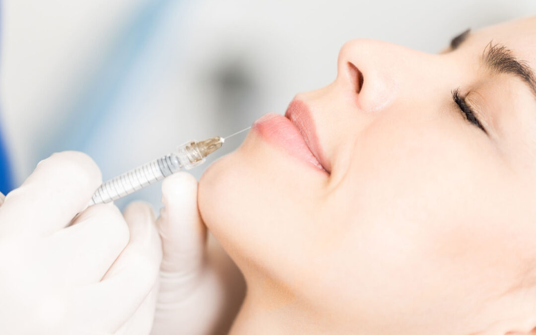 Naturally Beautiful Lips with Lip Augmentation in Melbourne