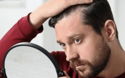 Understanding Hair Loss: Causes & Effective Treatments