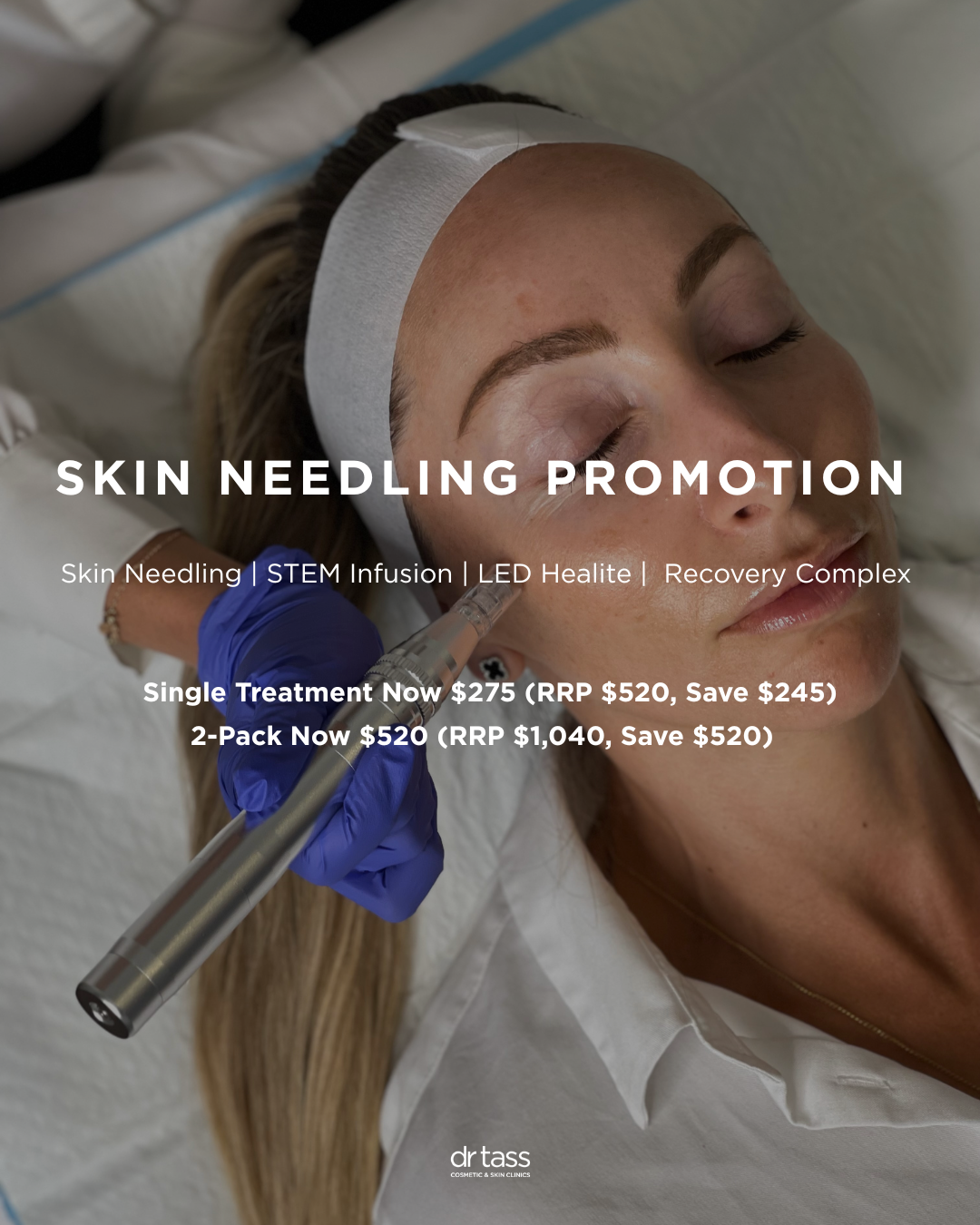 Before & After's (New Insta size) (12) microdermabrasion melbourne