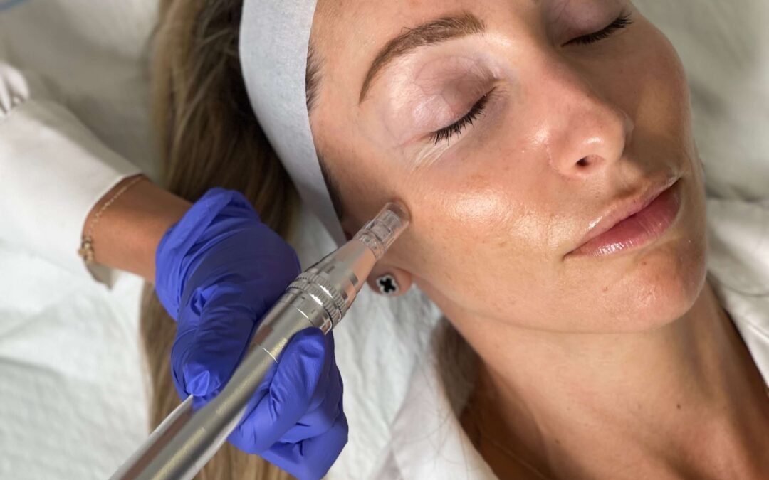 Winter Skin Care Tips: How to Keep Your Skin Hydrated and Healthy This Season