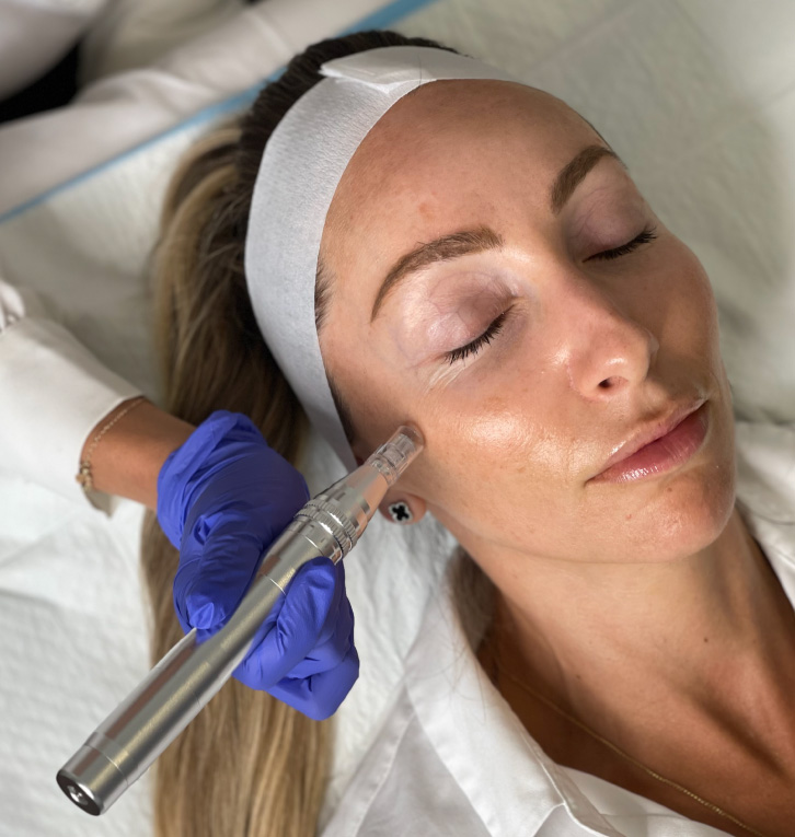 dermal fillers