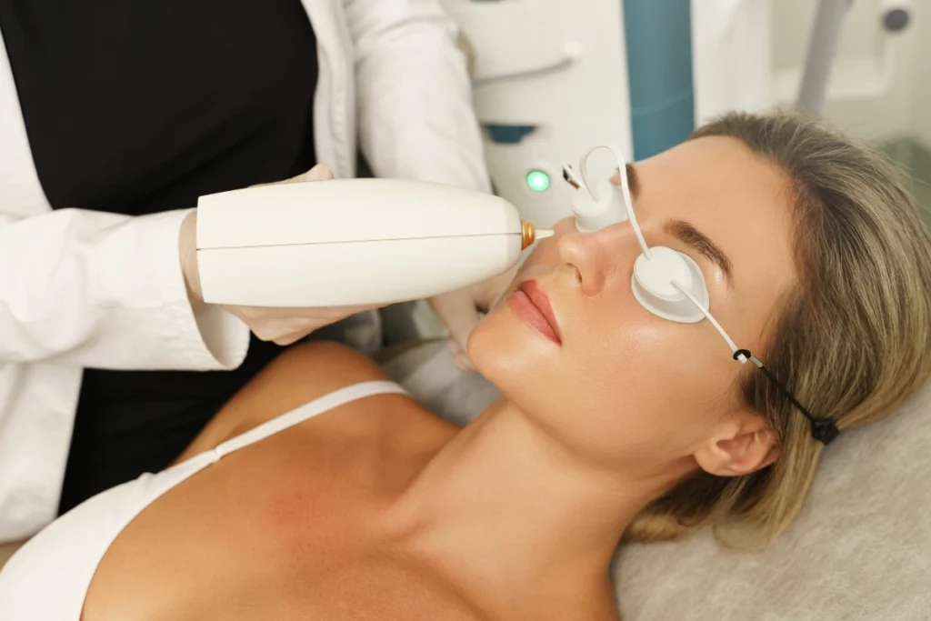 clinical rosacea treatment laser options at Dr Tass Melbourne skin clinic