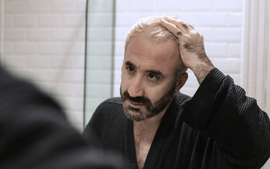 How Much Will a Hair Transplant Cost?